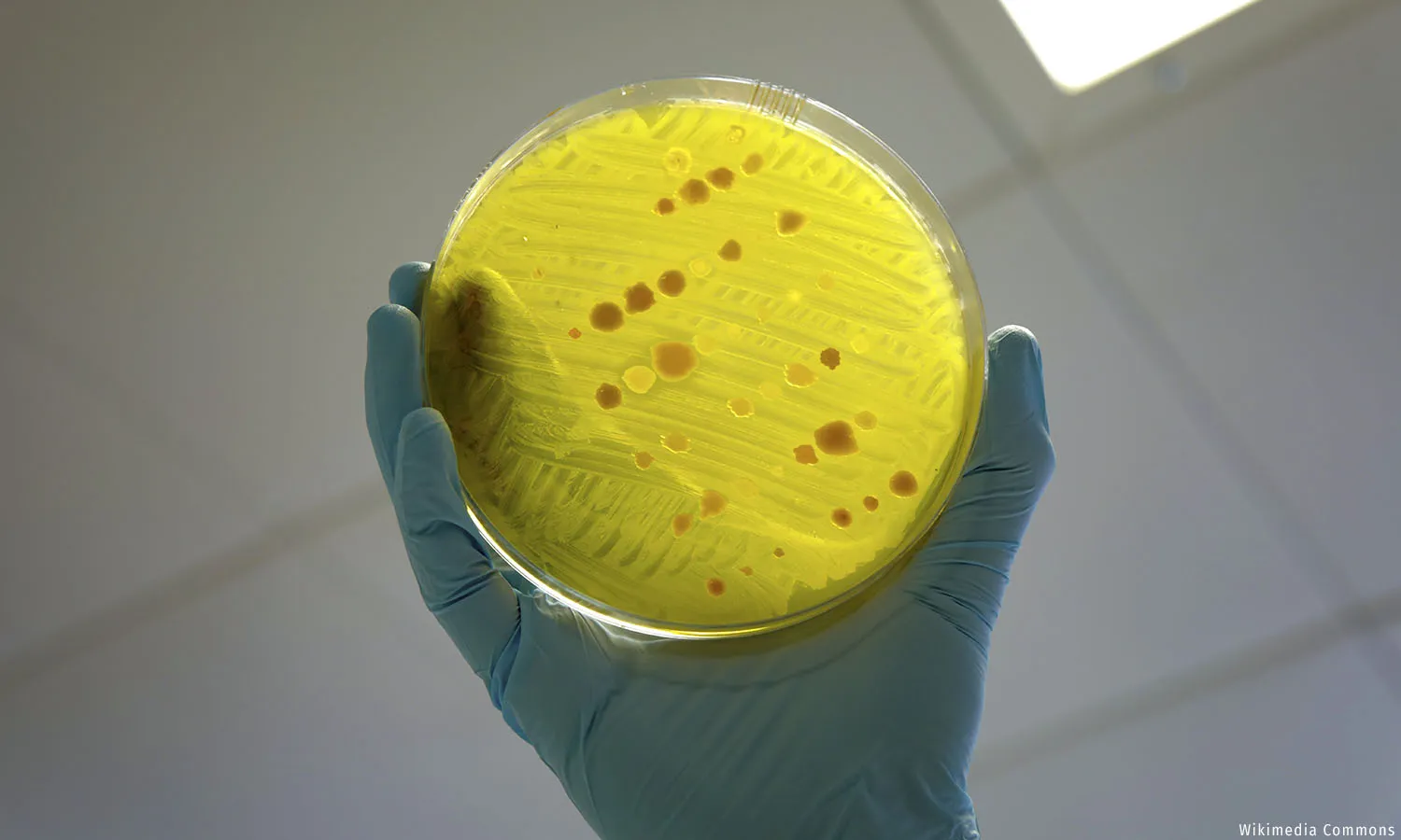 India Must Act Swiftly To Stop This ‘Silent Pandemic’ From Becoming Catastrophic India Must Act Swiftly To Stop This ‘Silent Pandemic’ From Becoming Catastrophic