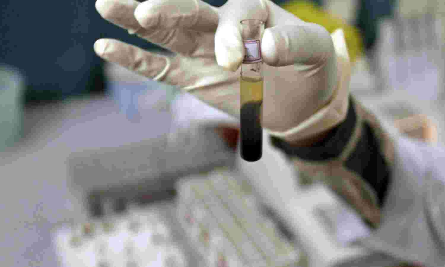 14,474 Cases Of HIV Through Blood Transfusion, But Govt Denies Crisis