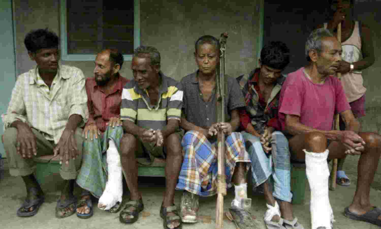 Unless India Delivers, World Won’t Be Leprosy Free