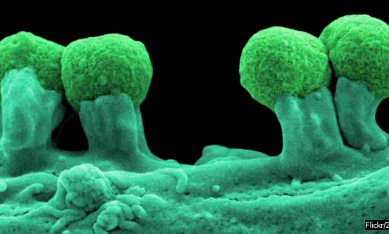 In 5 Years, Threat Of Drug-Resistant Superbugs Doubles