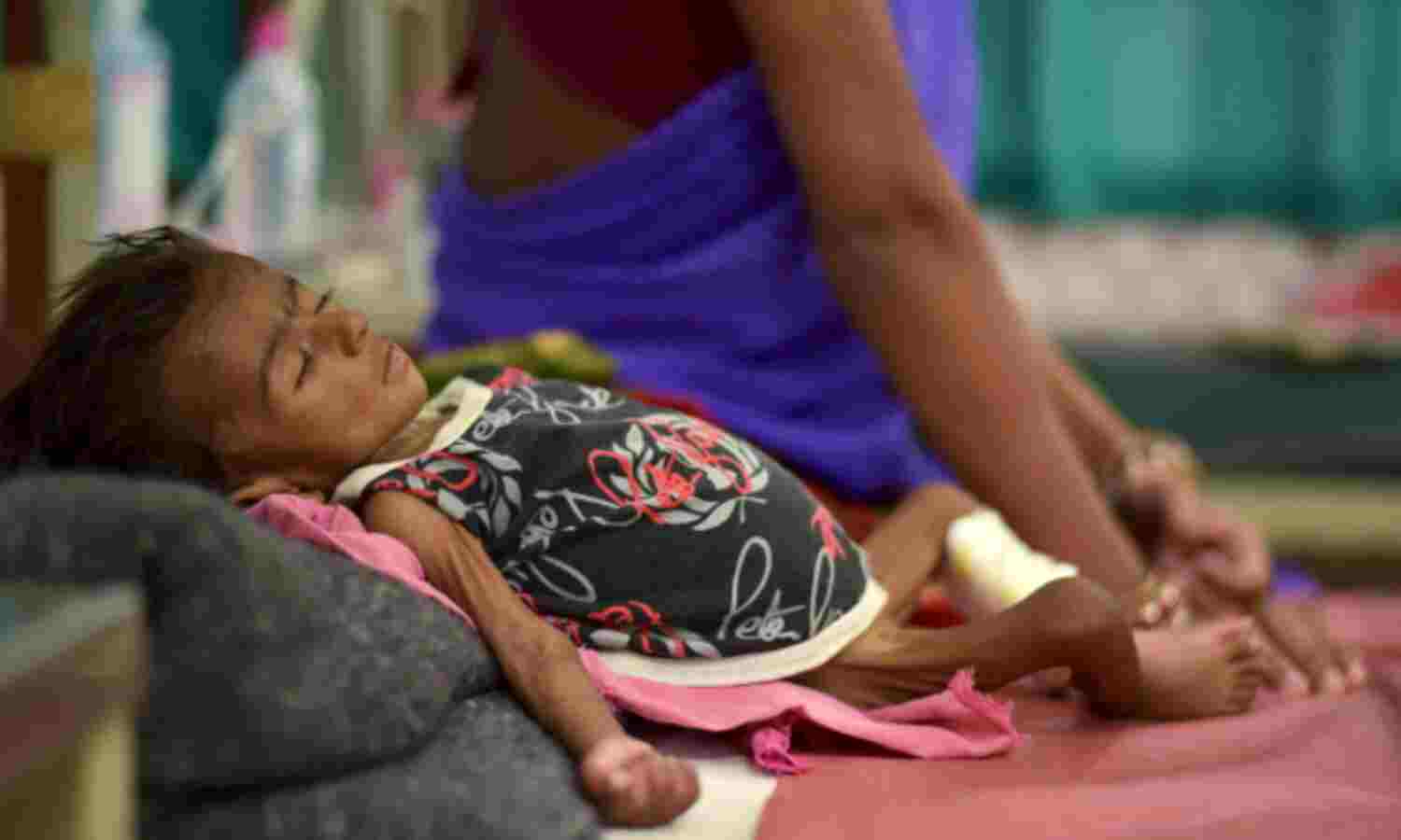 Why Malnutrition Remains A Challenge For India