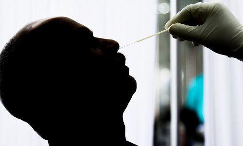 Need For Active COVID-19 Testing, Not Passive: Punjab Study Need For Active COVID-19 Testing, Not Passive: Punjab Study