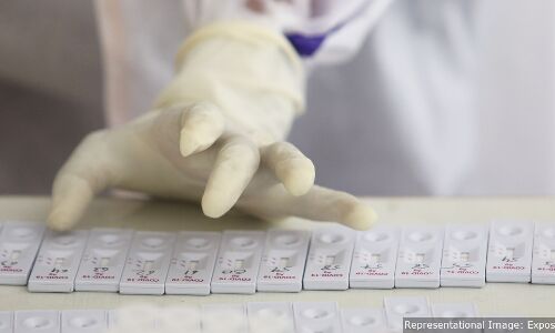 States Are Using More Antigen Testing. Heres What This Means States Are Using More Antigen Testing. Heres What This Means