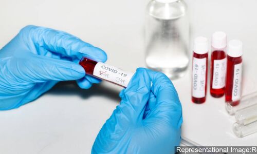 Study On COVID-19 Testing Data Calls For Random Testing, Improved Data Quality Study On COVID-19 Testing Data Calls For Random Testing, Improved Data Quality