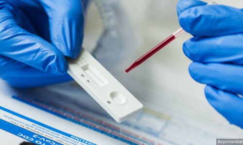 Doubts Over Antibody Testing Could Weaken India’s COVID-19 Strategy