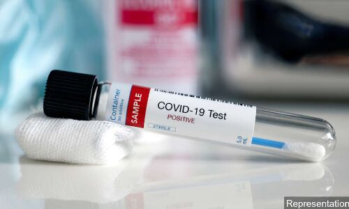 Explainer: What Happens During A COVID-19 Test Explainer: What Happens During A COVID-19 Test