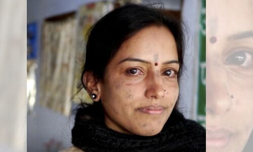 Do More Detected Cases Mean Leprosy Is Making A Comeback In India? Experts, Government Differ