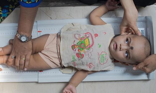 In A Mumbai Slum, Children Become Healthier, As Their Parents Learn To Tackle Malnutrition In A Mumbai Slum, Children Become Healthier, As Their Parents Learn To Tackle Malnutrition