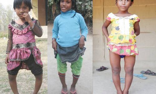 Fluoride Contamination Cripples More Than 1,000 Children In Assam Fluoride Contamination Cripples More Than 1,000 Children In Assam