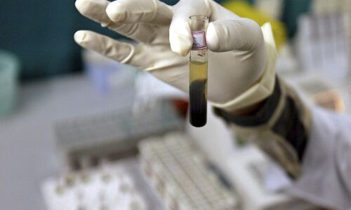 14,474 Cases Of HIV Through Blood Transfusion, But Govt Denies Crisis