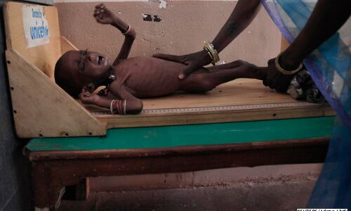 Last 5 Years, Number Of Undernourished Indians Rises Last 5 Years, Number Of Undernourished Indians Rises