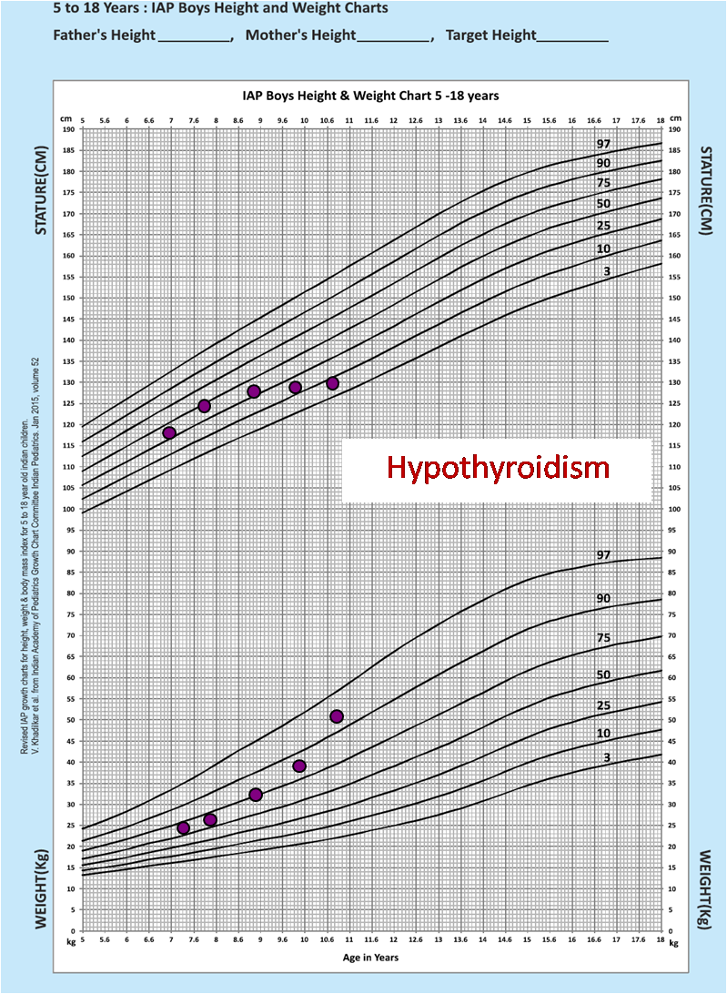Hypothyroidism showing as growth failure on new iap chart